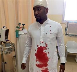 بعد عدة حوادث مشابهة.. طالب يشج رأس معلم بعصا غليظة ويسبب له إصابة بليغة بالباحة (صورة) بعد عدة حوادث مشابهة.. طالب يشج رأس معلم بعصا غليظة ويسبب له إصابة بليغة بالباحة (صورة)